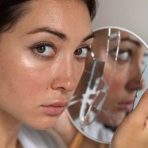 HOW DOES ACNE SCARS OCCUR? 