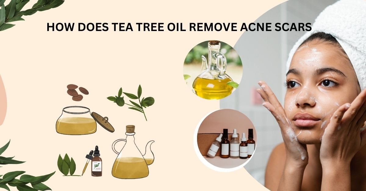 HOW DOES TEA TREE OIL REMOVE ACNE SCARS? 