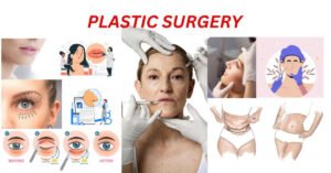 PLASTIC SURGERY