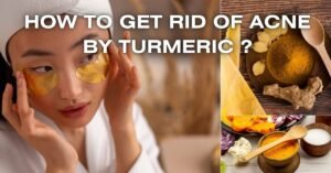 HOW TO GET RID OF ACNE BY TURMERIC?