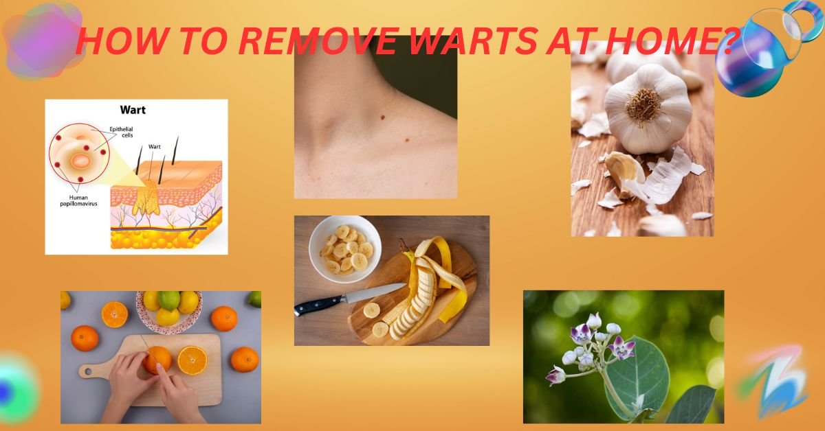 HOW-TO-REMOVE-WARTS-AT-HOME.jpeg