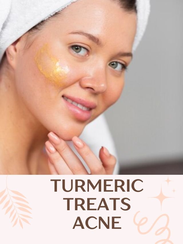 TURMERIC TREATS ACNE