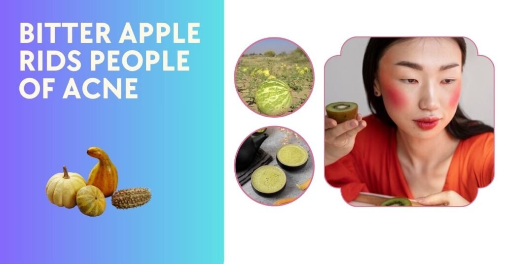 What is BITTER APPLE RIDS PEOPLE OF ACNE