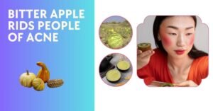 BITTER APPLE RIDS PEOPLE OF ACNE