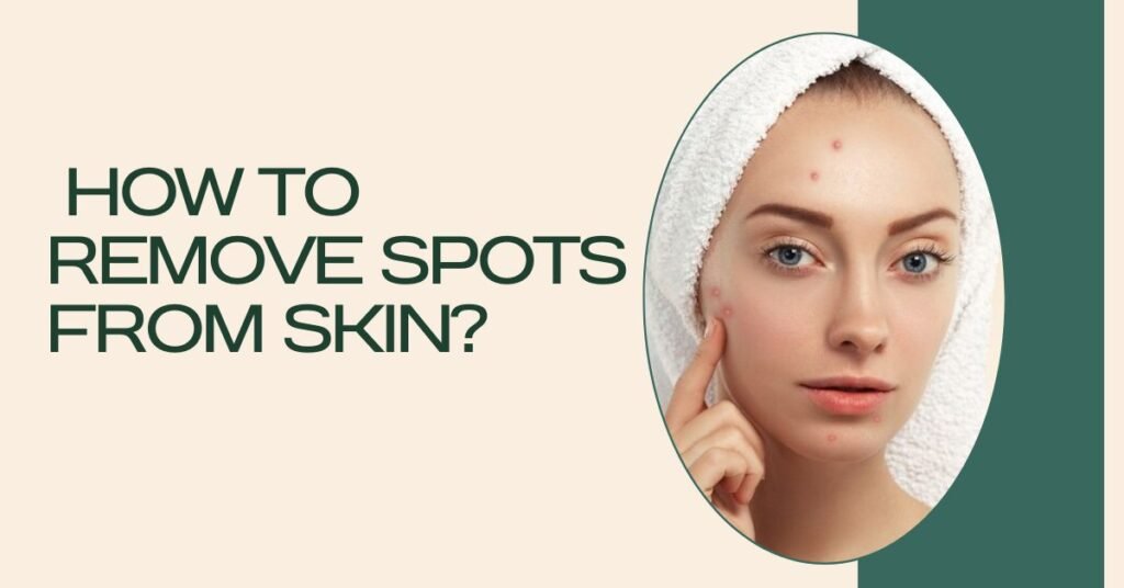 HOW TO REMOVE SPOTS FROM SKIN?