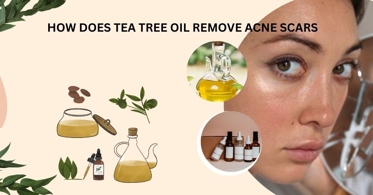 HOW DOES TEA TREE OIL REMOVE ACNE SCARS?